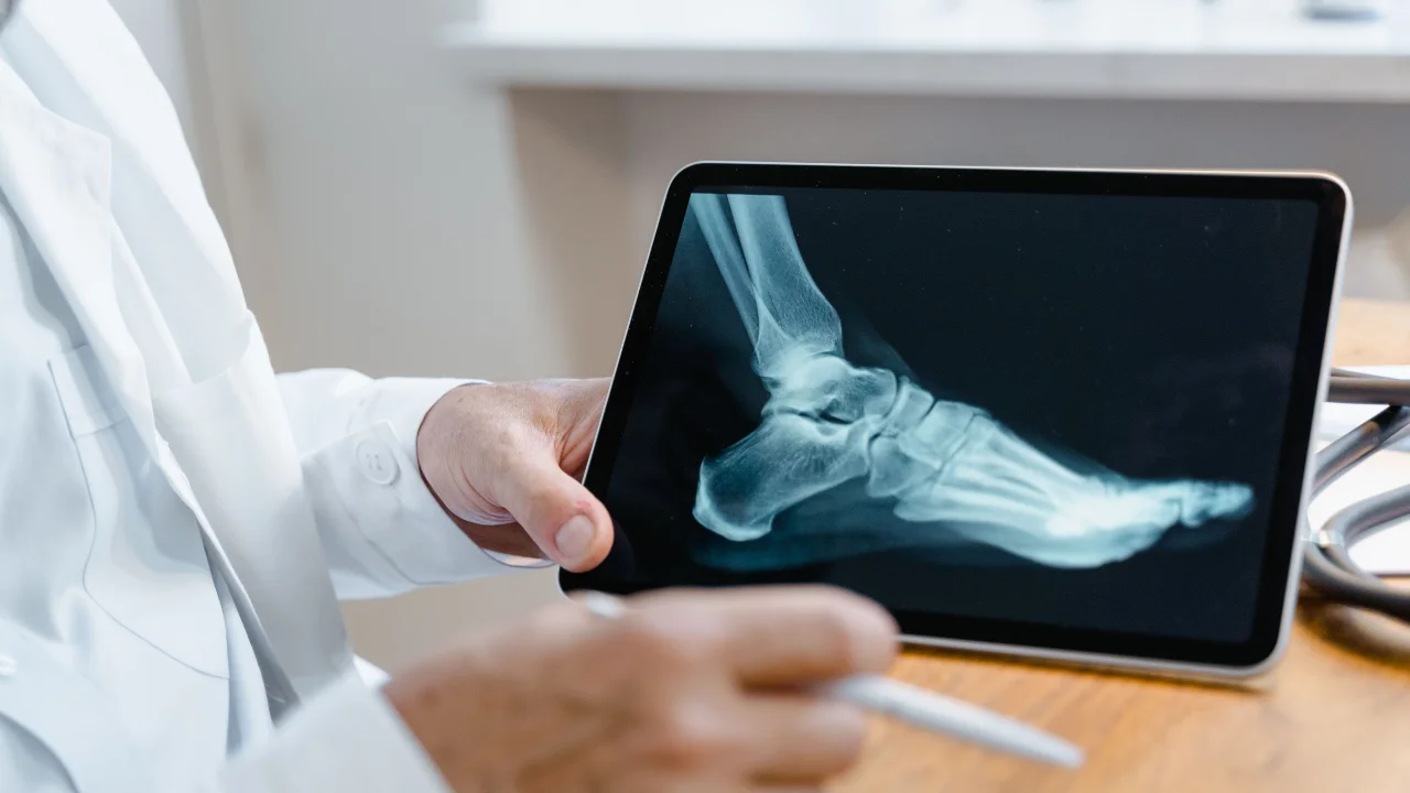 A doctor is showing the Bone Tumor and explaining to the patient the procedure of operation by an X-ray film in Dhaka